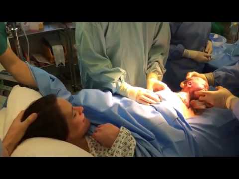 شاهد إنجليزية تلد قيصري طبيعي في نفس الوقت