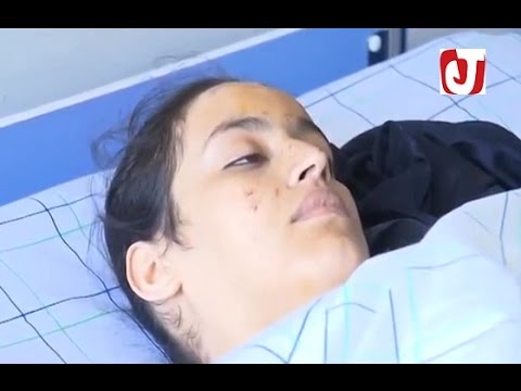 شاهد تفاصيل حادث انقلاب حافلة نقل المسافرين في منعرج خطير