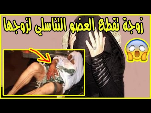 مغربية تقطع العضو التناسلي لزوجها انتقاما لخيانته لها