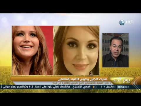 شاهد أخصائي تجميل يوضح سر التشبه بالمشاهير