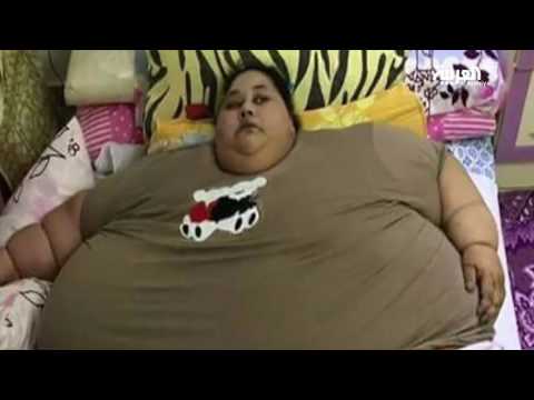 إيمان تزن نصف طن وتطالب بخفض مائة كيلوغرام قبل علاجها