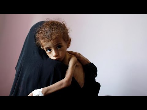 شاهد الأمم المتحدة تُحذر من مجاعة وشيكة ستضرب في اليمن