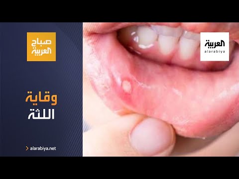 كيف يمكن تفادي أمراض اللثة والقول أنها تعاني من الأمراض
