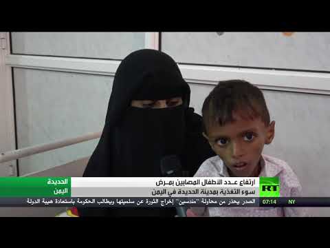 الحرب اليمنية تتسبب في تفاقم معاناة الأطفال