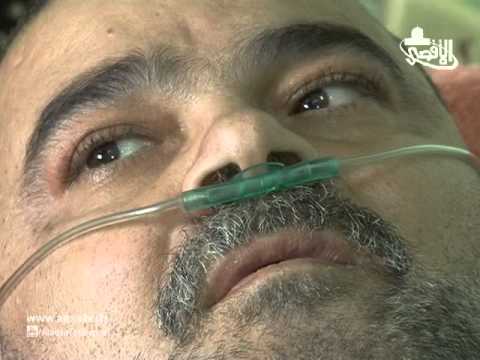 شاهد أسير محرر يُطالب الحكومة بعلاجه خارج البلاد