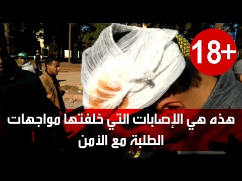فيديو نتائج المواجهات بين الطلبة والأمن في فاس
