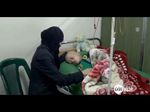 شاهد نقص العلاج يودي بحياة مرضى السرطان المحاصرين في ريف دمشق