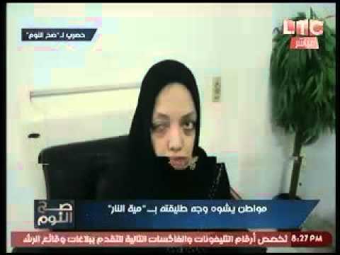 بالفيديو مواطن يشوِّه وجه طليقته لنيّتها الزواج من آخر
